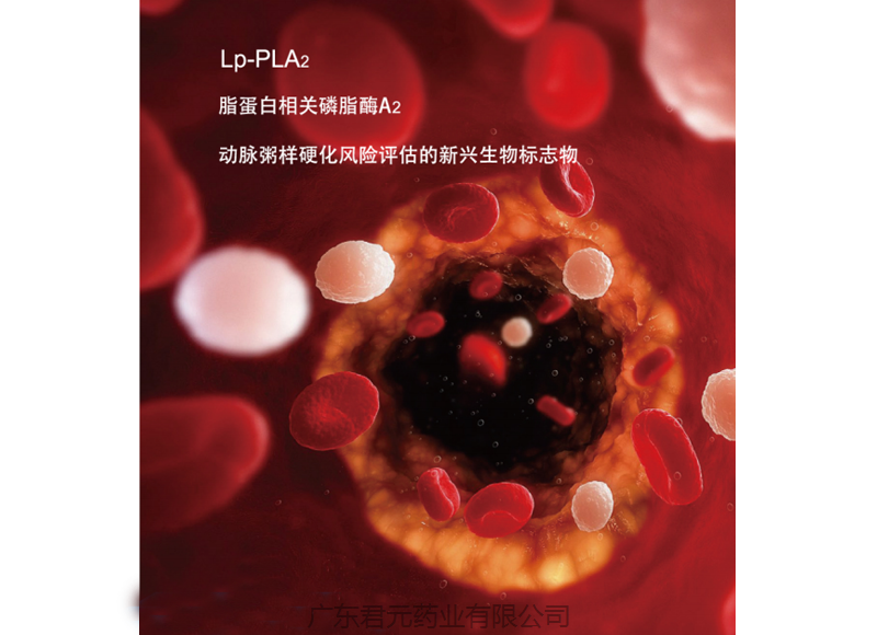 Lp-PLA2----動脈粥樣硬化斑塊穩定性的評估標志物